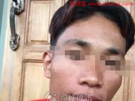 “5人拿枪看着我，让我家人拿100万赎人···我趁机就溜了！”缅甸男子分享被绑经历
