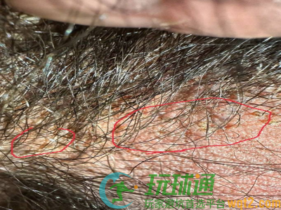 网友投稿：兄弟们小心，小黑不干净！